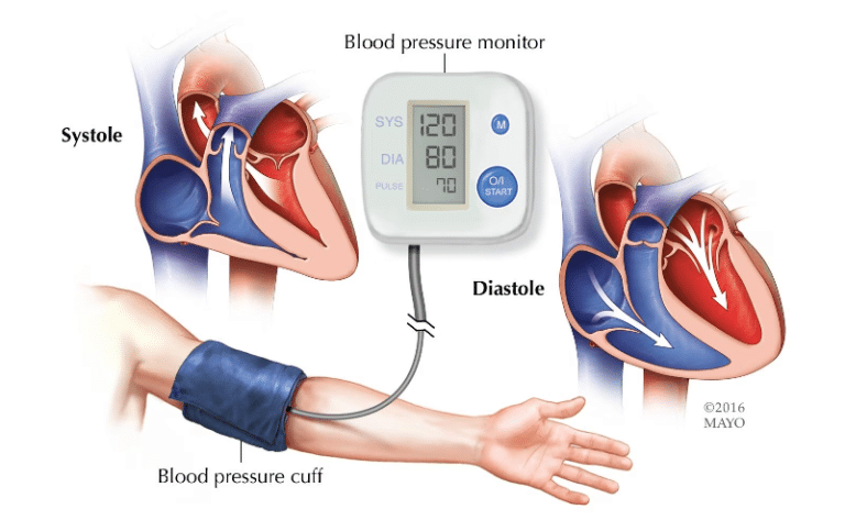 blood-pressure